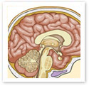 Brainstorm : Medical Illustration