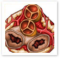 Heart - Blood Circulation : Medical Illustration Heart - Blood Circulation : Medical Illustration